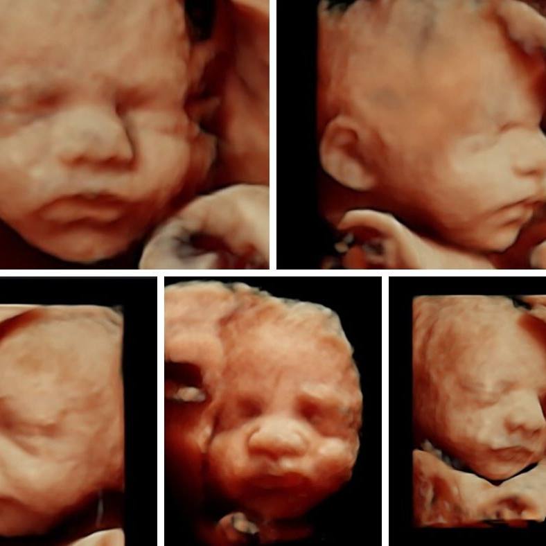 Diseno sin titulo 5 1