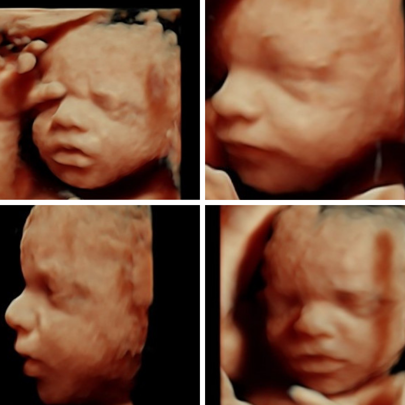 Diseno sin titulo 6 2